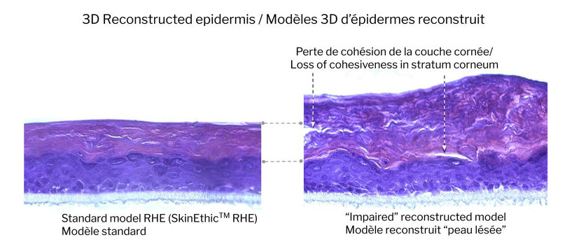 Reconstructed Epidermal Sections – Development of a new "Impaired Skin" model