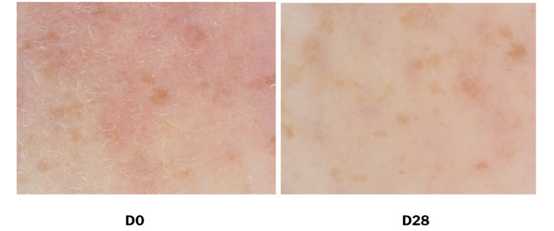 C-Cube images analysis show that 10% of EMOGREEN™ L19 incorporated in an O/W emulsion improves visibly the aspect of very dry skin (<30 a.u.) after 28 days.