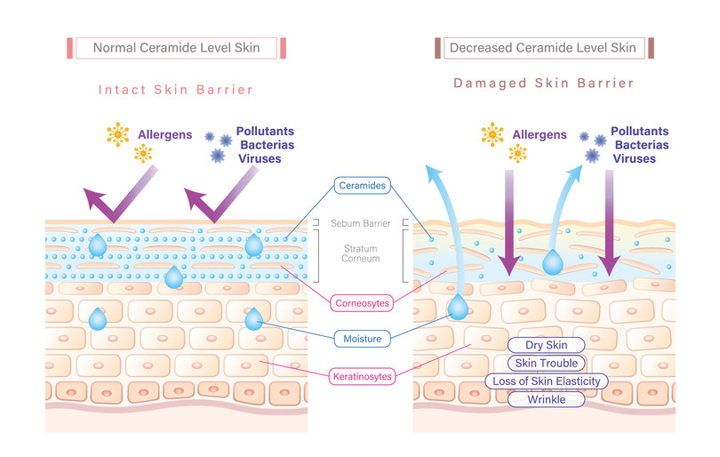 ceramide, skin benefits